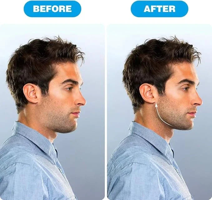 SharpJaw™- Jaw Shaper & Facial Toner | Sculpt, Shape & Lift | Compact Jaw Exerciser